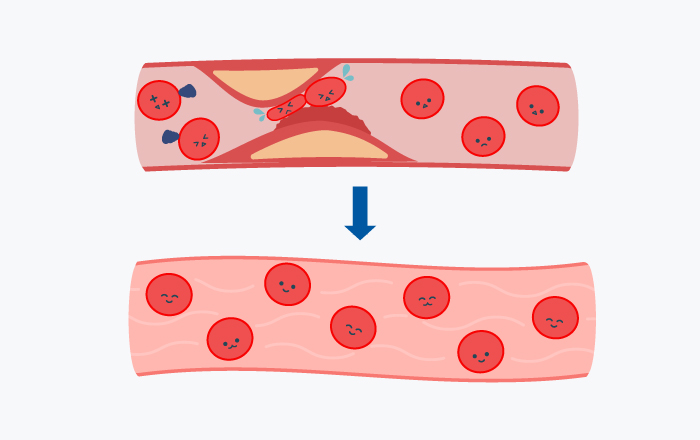 血管のイラスト